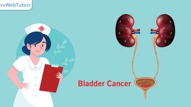Nursing Assignment on Bladder Cancer