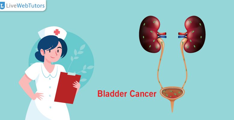 Nursing Assignment on Bladder Cancer