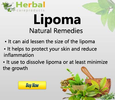 Treat Lipomas Without Surgery