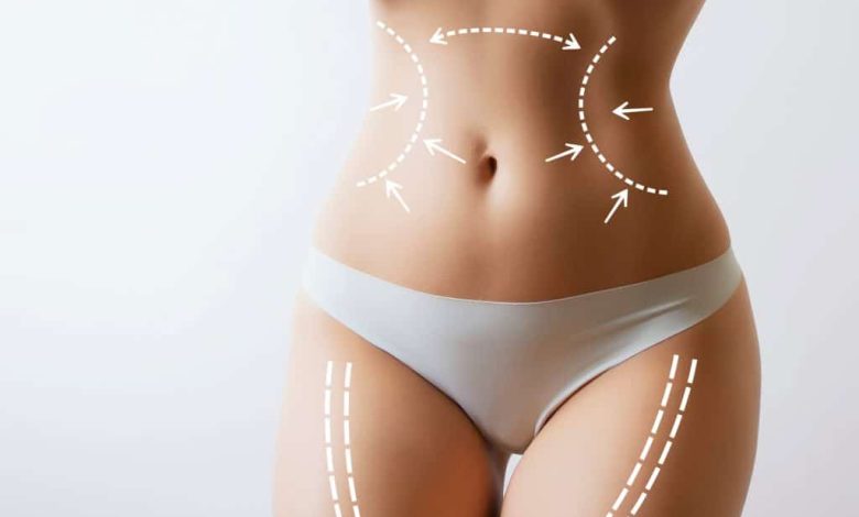 Body Contouring in Orlando