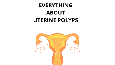 everything about Uterine polyps